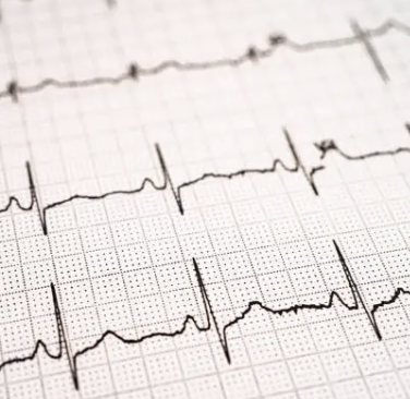 ECG Report Analysis thumbnail
