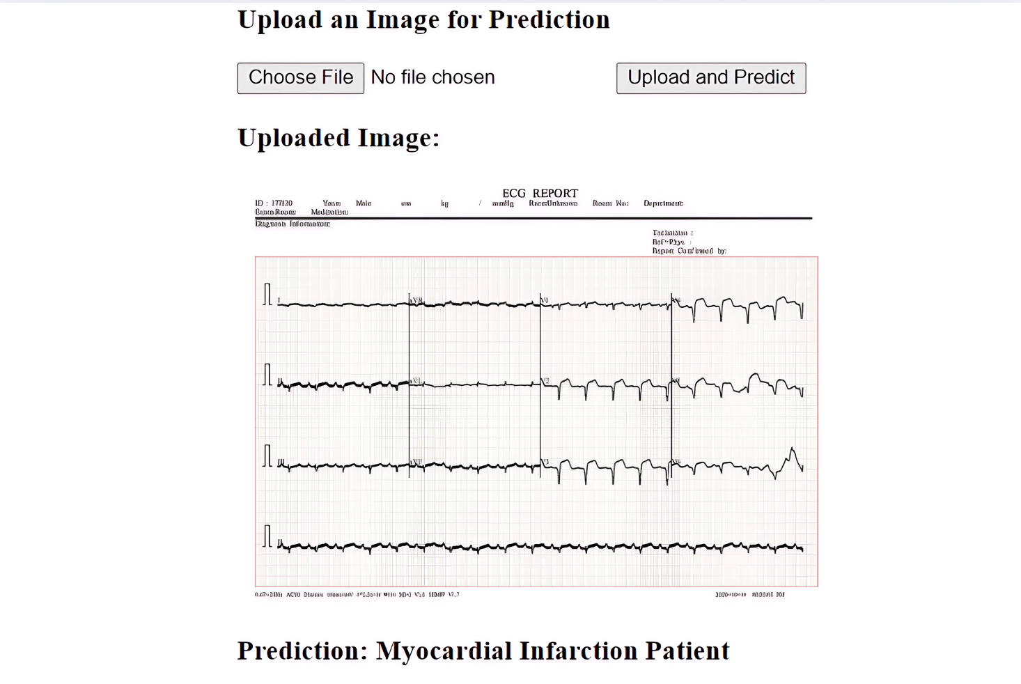 ECG Report Analysis tool screenshot